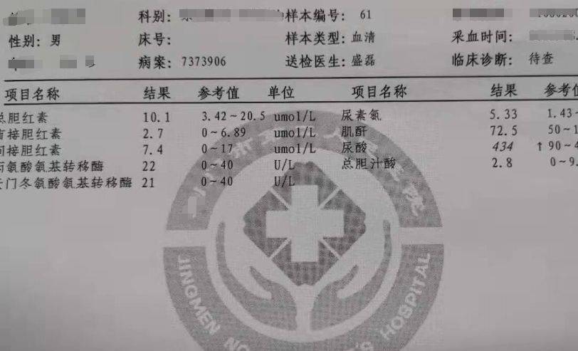 化验单体检尿酸高得吓人你知道怎么治疗吗痛风专家张卓教你