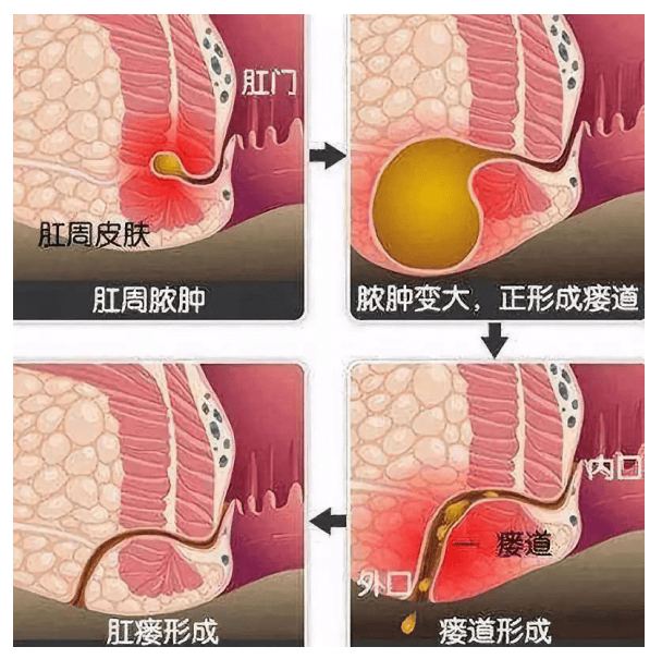 肛门六点位置图图片