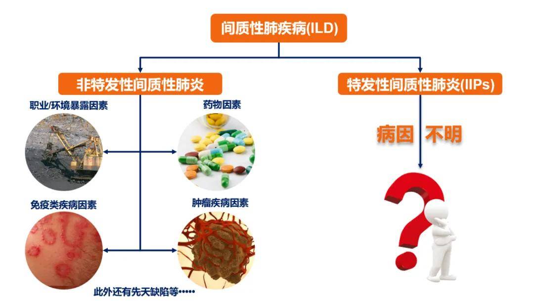 间质性肺炎传染吗图片