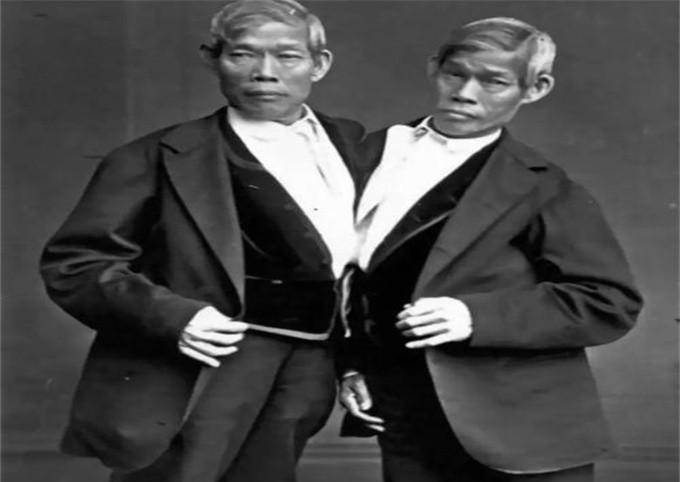 华裔连体兄弟走红后,娶了一对英国姐妹花,一起生下22个孩子