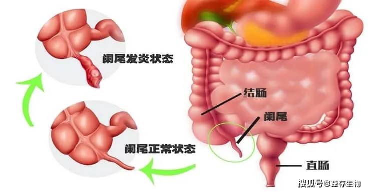 去除肠道细菌潜在的安全屋