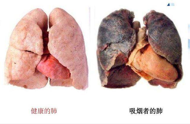 戒烟多久肺才干净图片