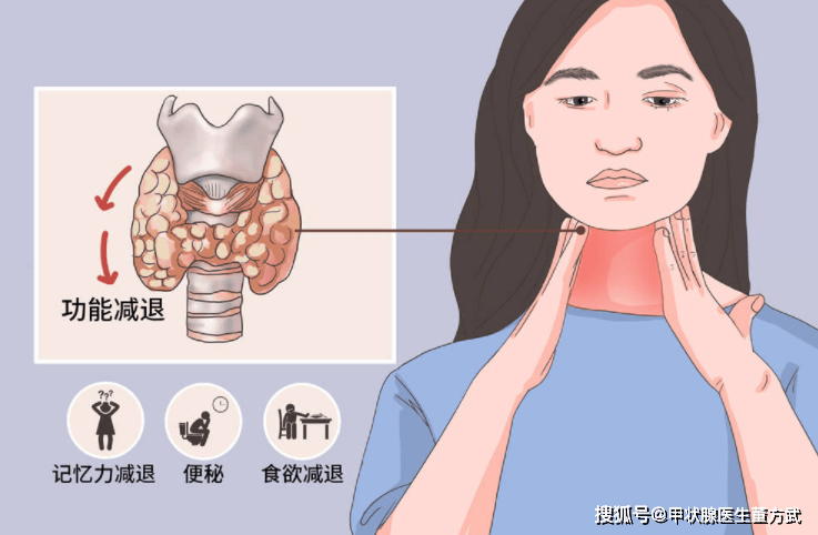甲减拖延的后果很严重,出现这些症状要当心甲减!