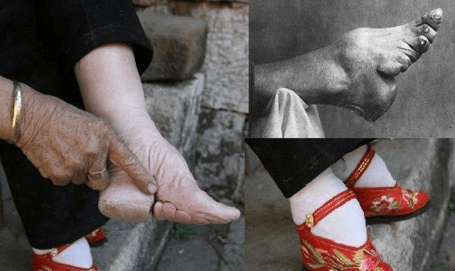 缠足起源于北宋中后期,兴盛于南宋.