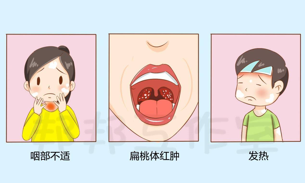 扁桃体到底割得不?专家说,有这几种情况就必须割!