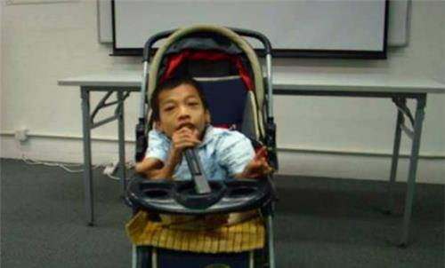 美国著名作家海伦·凯勒在出生的第19个月,便因为患急性胃出血和脑