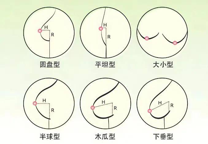 胸外扩图片下垂正常图片