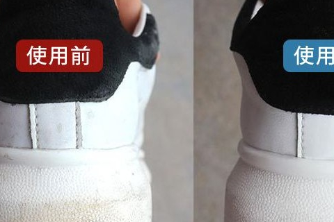 白鞋变黄怎么办?学会这几种小妙招,让你的小白鞋脱胎换骨!