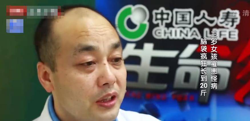 "是发病率不到千分之一的严重脑积水!