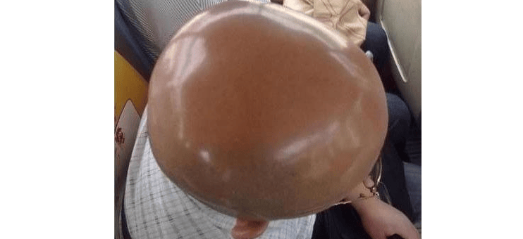 粘毛3D纹发：肉叶了，长不出指甲咋办？(图4)