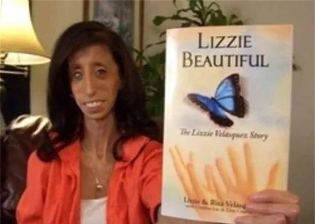 400万人咒她去死,这个被称为"全球最丑的女人",终于选择反击