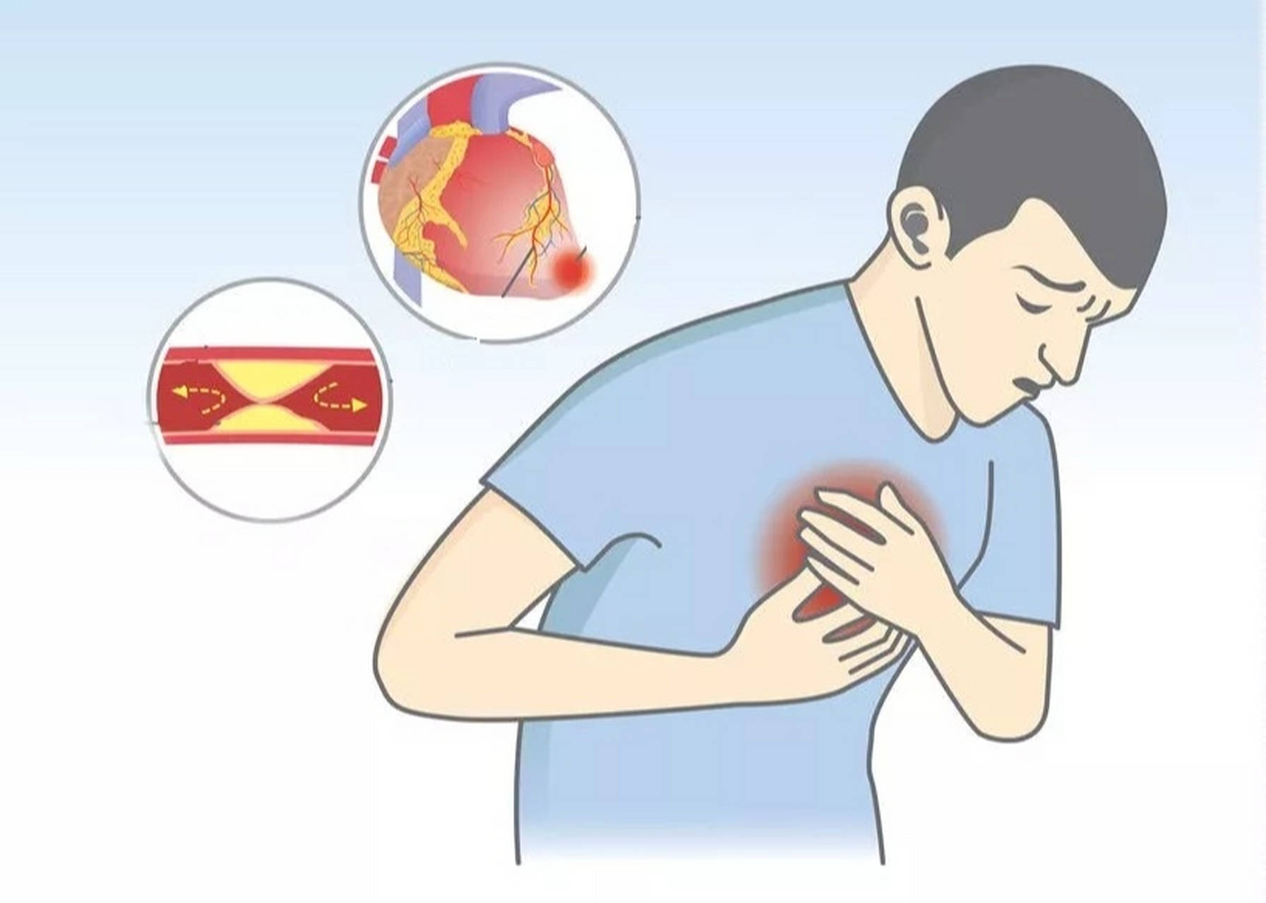 心绞痛常见于40岁以上男性或绝经期以后女性,常年高血压,糖尿病,高