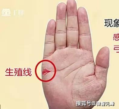 生命线_尾部_方面