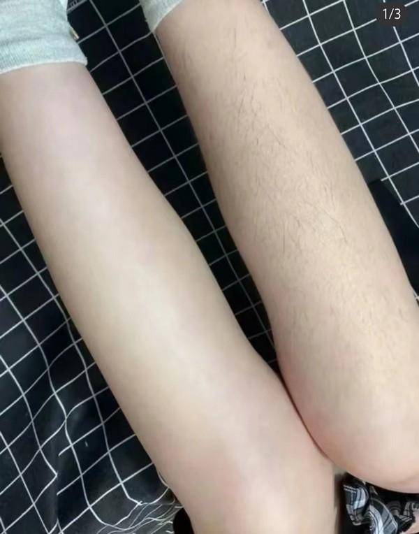 冰肌玉骨 无痛脱毛 DOCO蓝宝石冰点脱毛仪