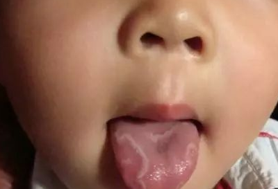 宝宝的舌头又白又红，是反复患病的预警！2招教你正确护理_地图_舌苔_脾胃