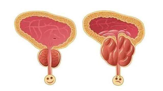 男性"器官衰老"顺序表公布,自测一下,看看你进行到哪一步