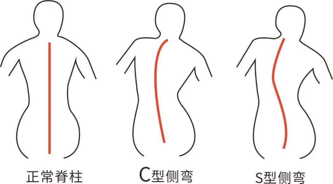 体态侧面图图片