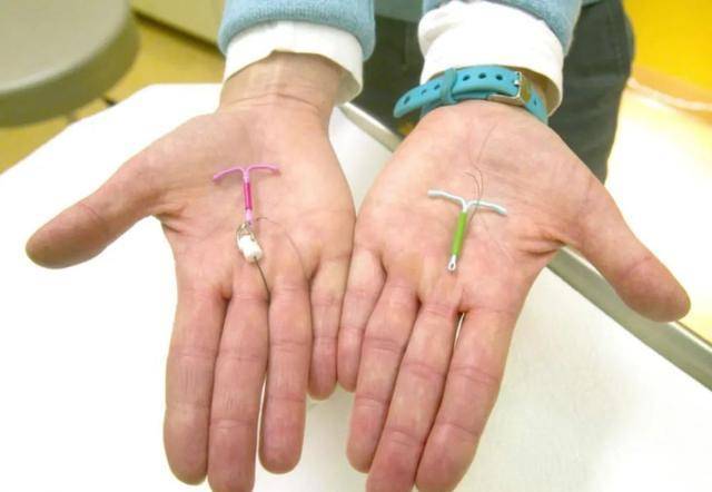 首批"上环"的女性,现在怎么样了?医生:或要面临3种结果