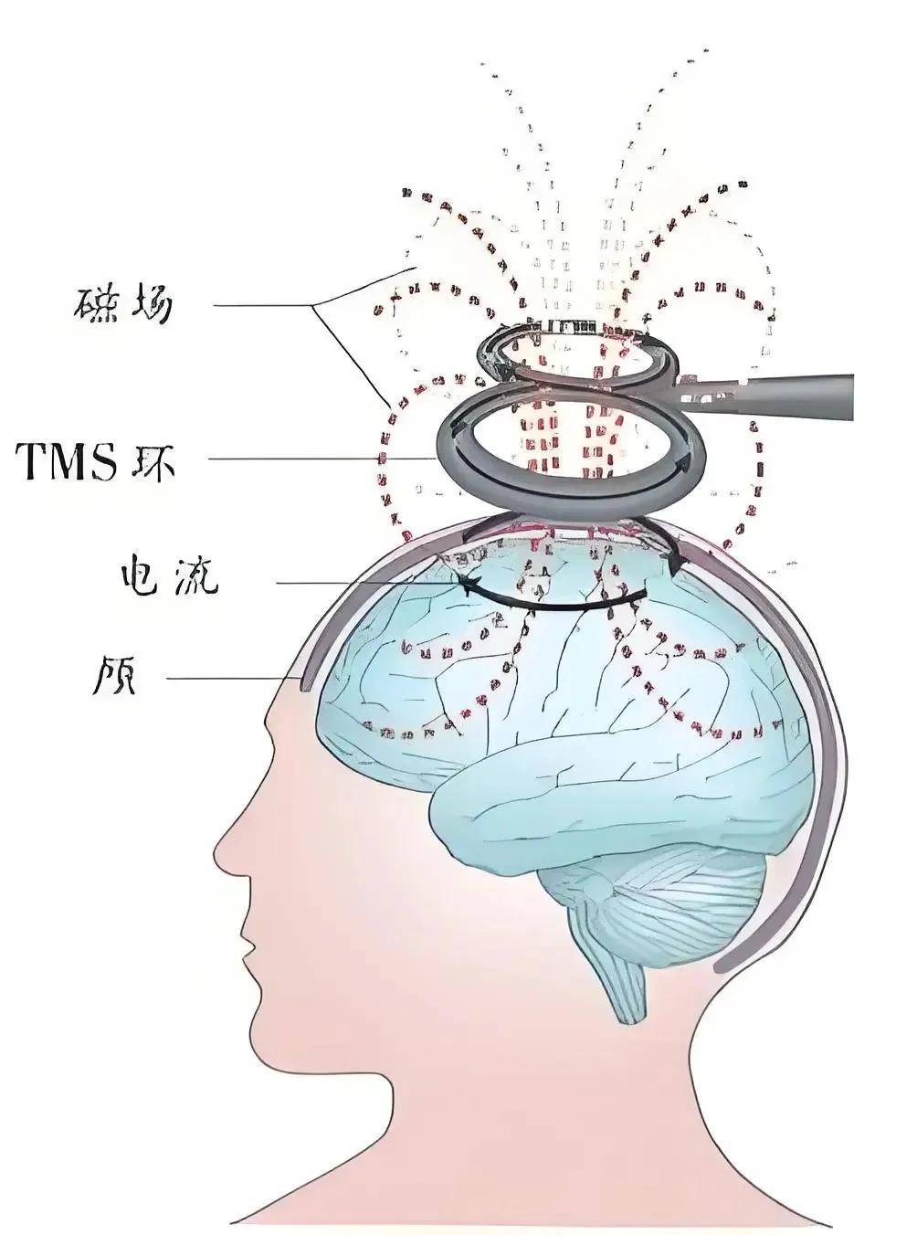 安眠药能吃死人吗图片