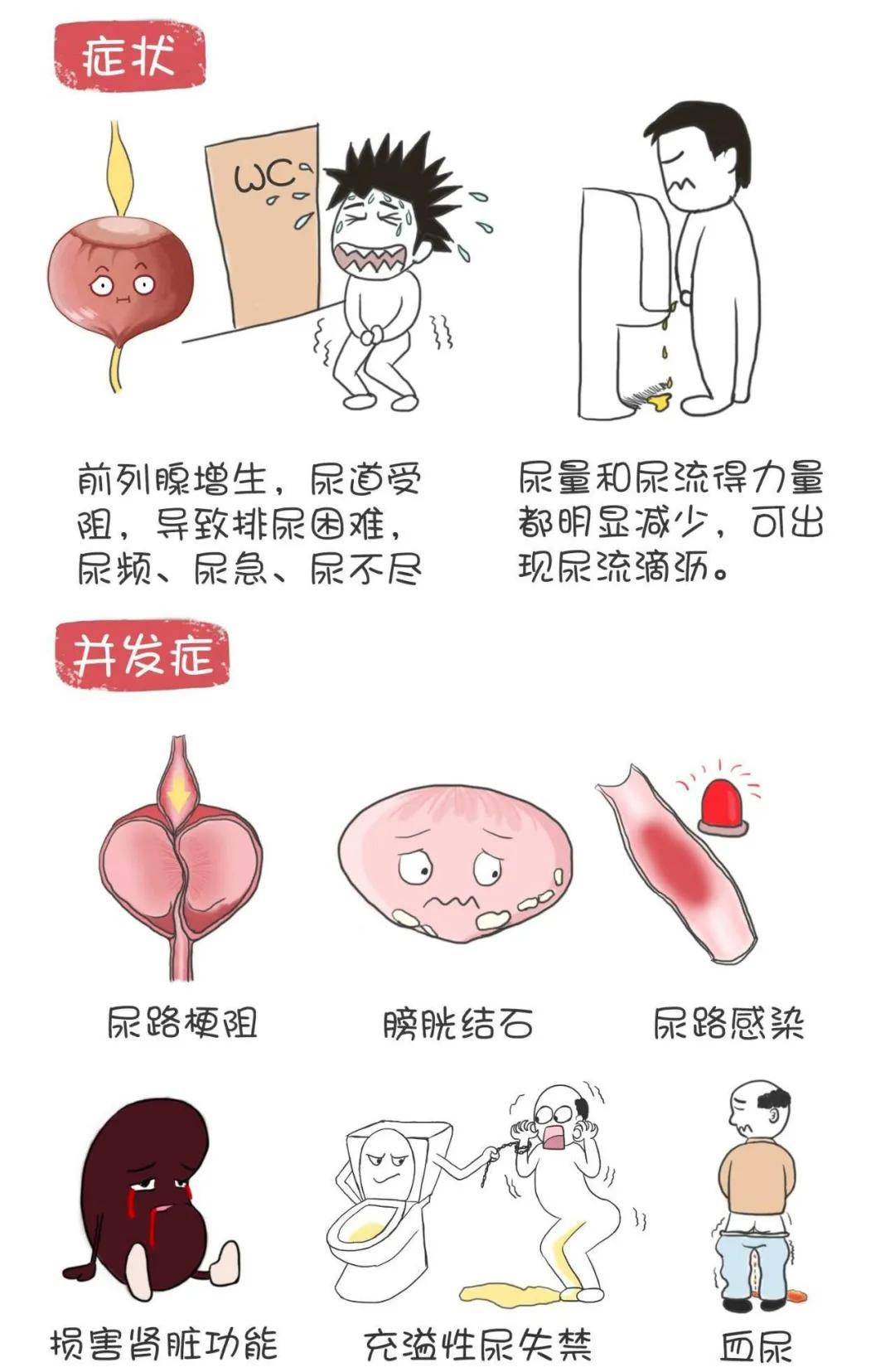 前列腺卡通图片图片