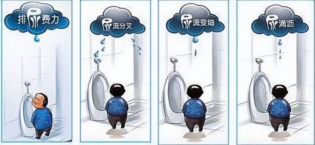 一是膀胱刺激症状.多表现为尿急,尿频,急迫性尿失禁,夜尿增多等.