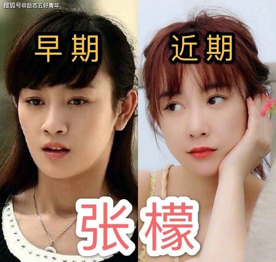 《墨雨云间》张檬出顶着"网红脸"出场,她怎么变成这样了?