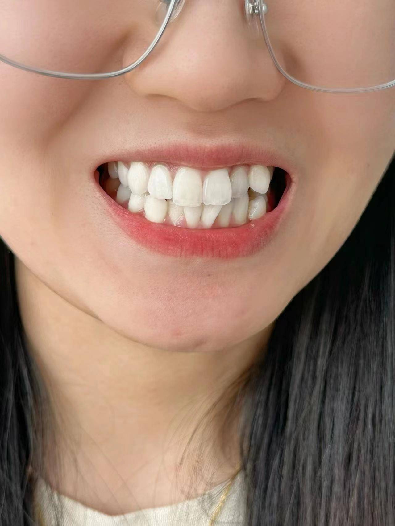 牙齿_牙粉_效果