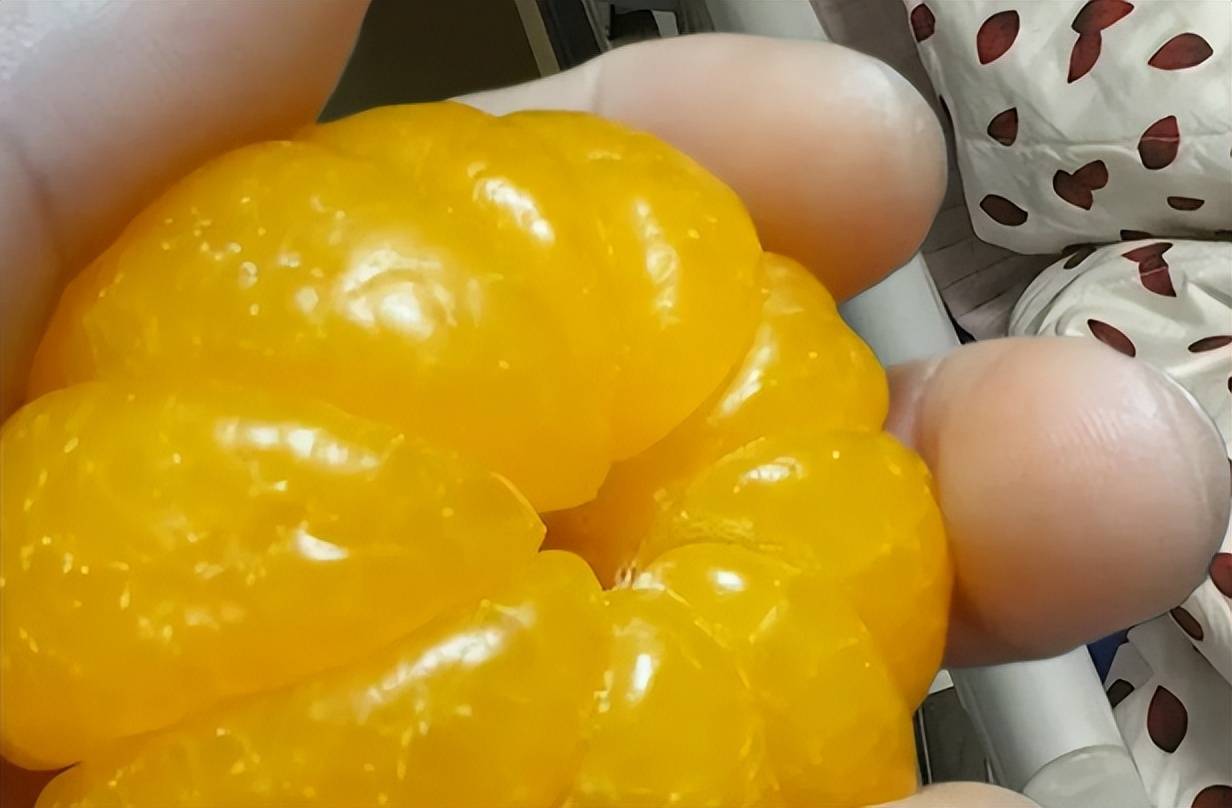 (已离职):教你三招,庤疮肉球轻松瘪掉还能不复发!