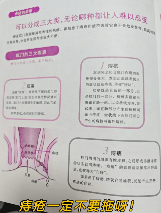 肛门外痔肉球怎么消除图片