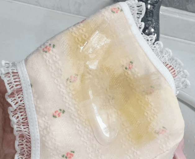 下面瘙痒异味,还有豆腐渣?教你7天搞定妇科反复!