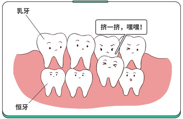 儿童牙齿出现哪些情况需要矫正？乳牙滞留如何处理？