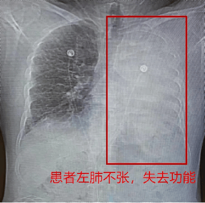 唐山市第四医院唐山市肺科医院当天就能挂上号的简单介绍