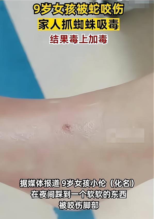 以毒攻毒?9岁女童被蛇咬伤,家人竟用蜘蛛吸毒,4天过去后悔莫及