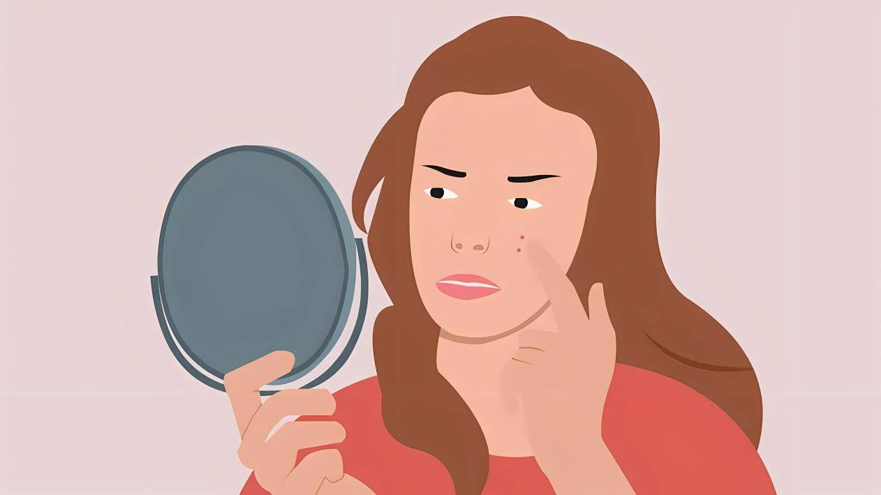 祛痘品牌哪个效果最好?祛痘口碑最好的十大排名