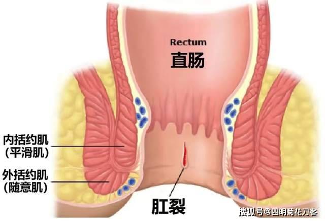 宁波肛肠外科微创专家