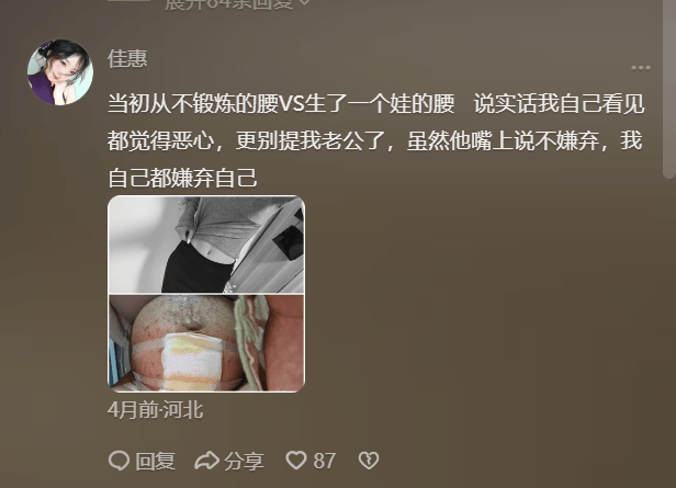 26岁女子晒出自己产后布满妊娠纹的肚子,产后身材走形的原因？