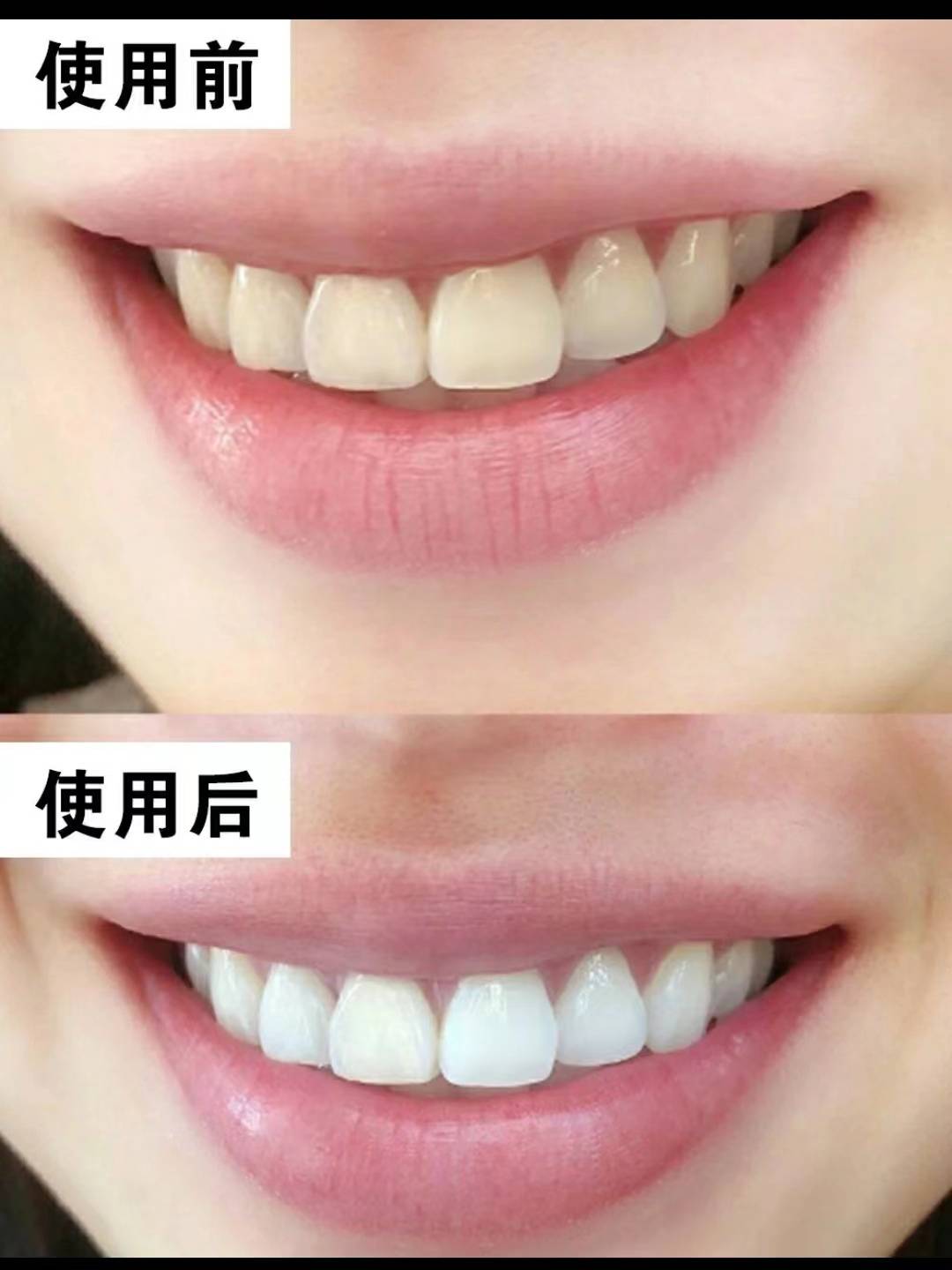 3个方法坚持一月实现白牙大逆袭!_牙齿_牙粉_护理