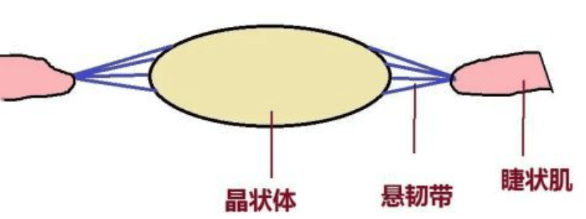 男子用筋膜枪按摩眼睛视力仅余0.1,已致白内障