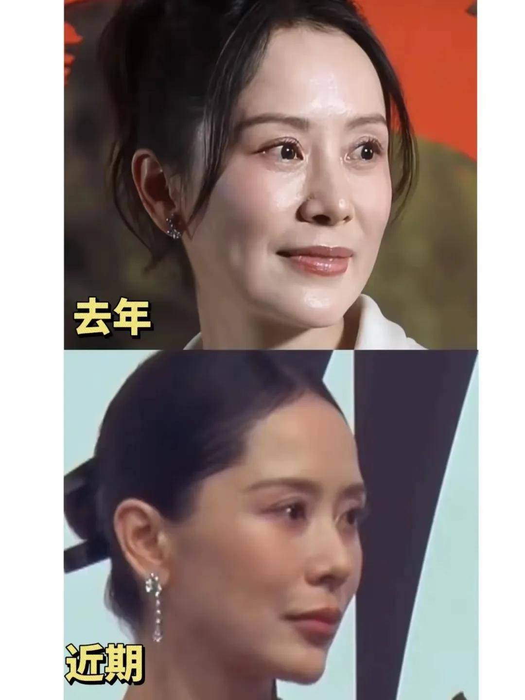 "国民媳妇"海清近照曝光,让人大呼不可思议,这整容整得太狠了