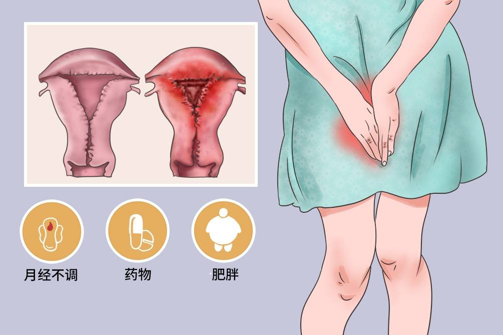 癌症月经图 宫颈癌图片