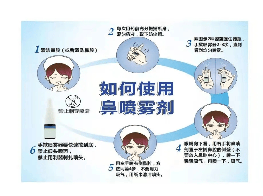 4 眼睛向下看,用右手将鼻喷剂置于左侧鼻腔的侧壁(不要放入鼻腔