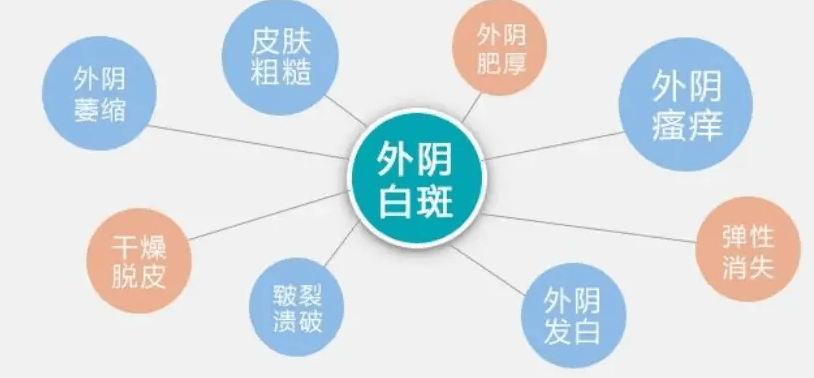 贵阳附大妇科白斑医学研究:炎症刺激为何会引起外阴白斑?