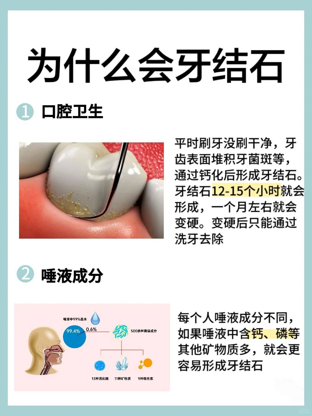 什么是牙结石怎么去除牙结石牙结石怎么护理