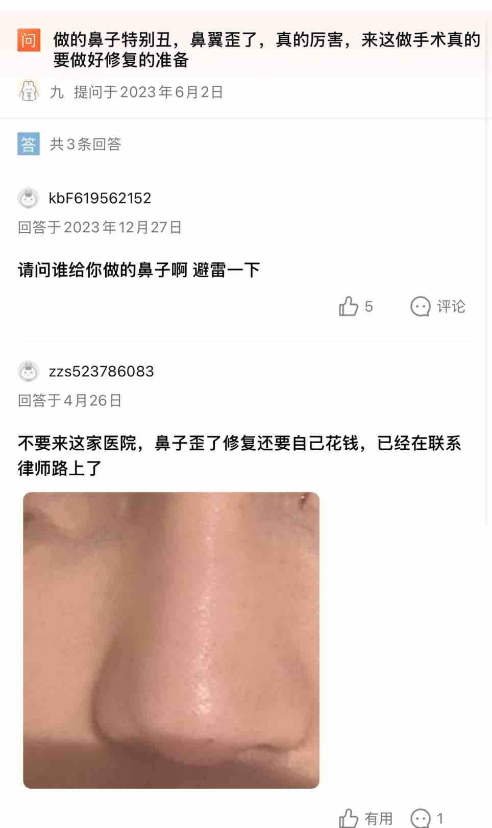 鼻子做歪投诉多 上海芙若拉医疗美容曾涉百万医疗事故(图10)