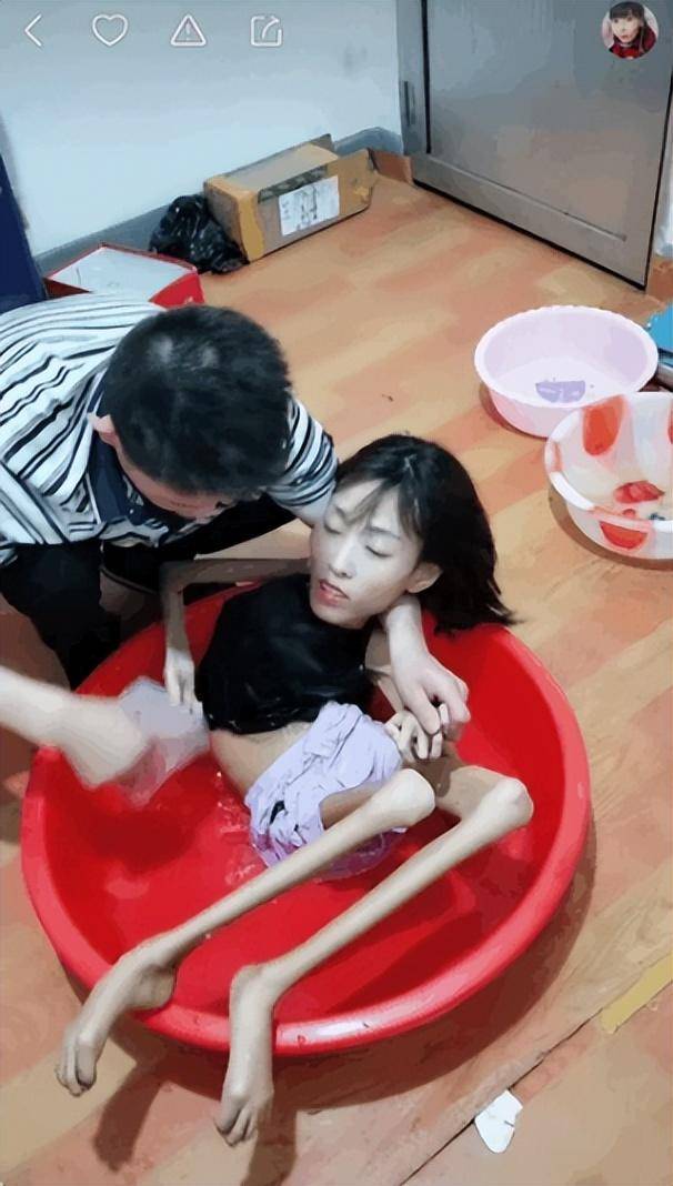 17年,帅小伙网恋30斤"骨头"女孩,次年结婚怀孕,结局如何