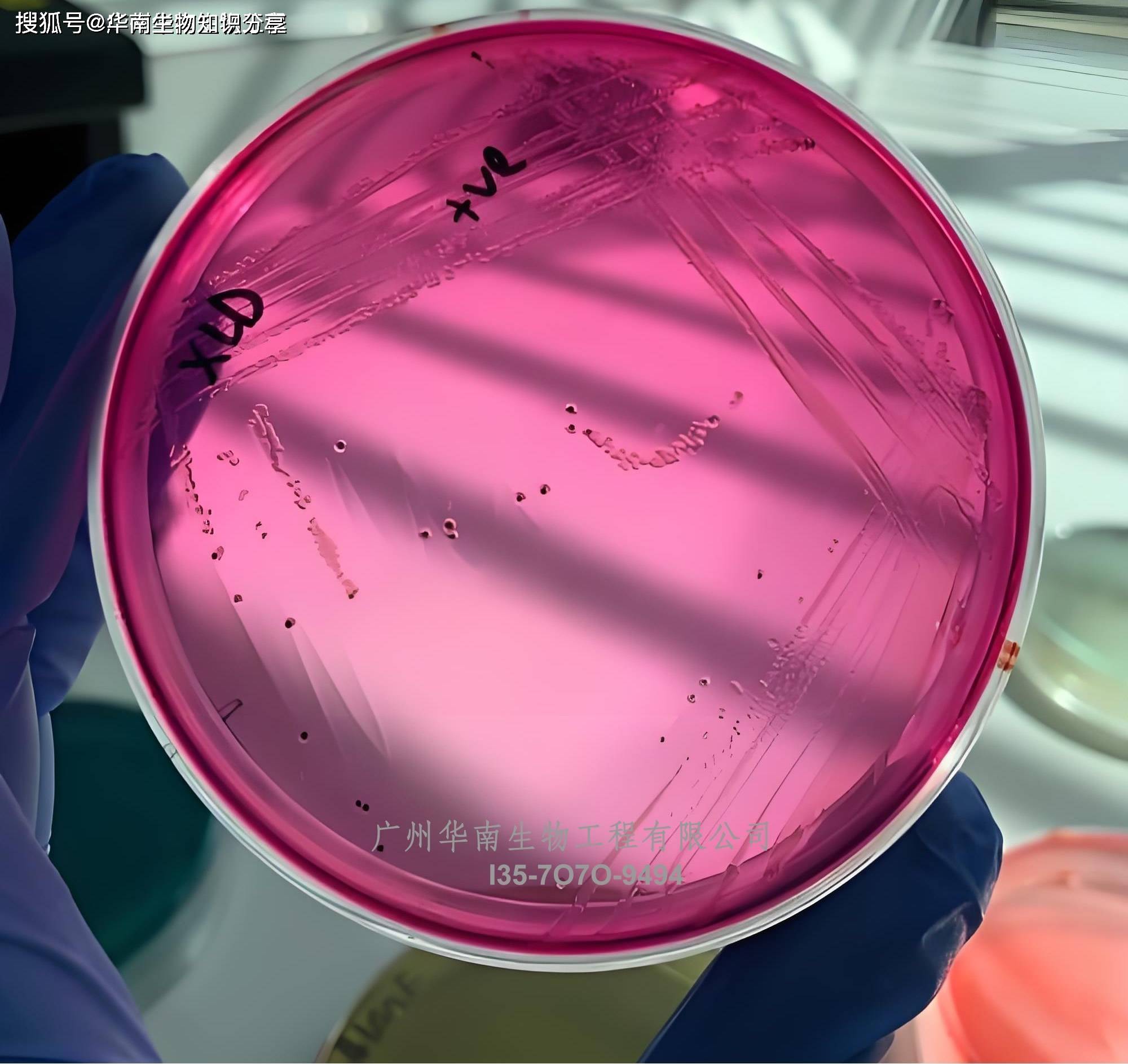 粪便霍乱弧菌检测试剂(快检)