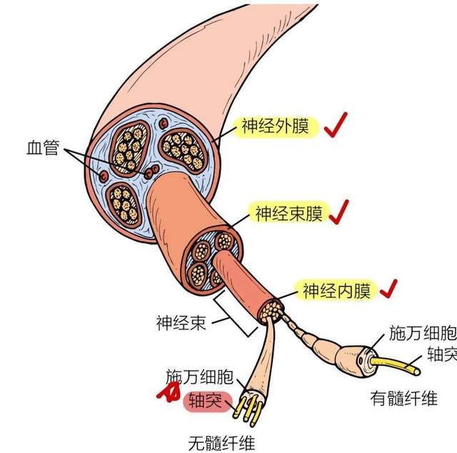 一针见效治疗偏瘫图解图片