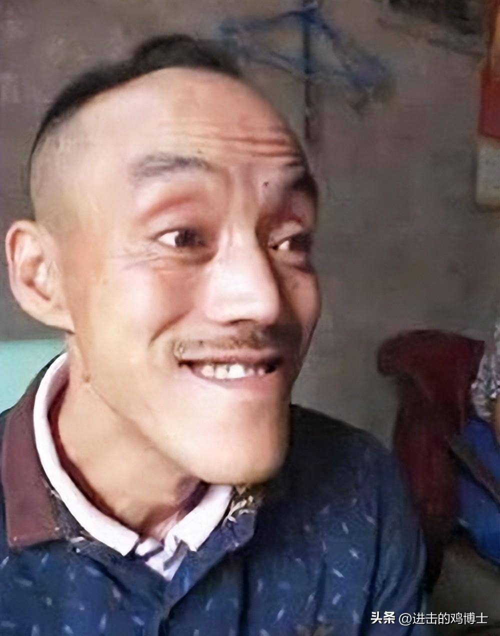 靠"光头强"走红的冯家六,娶美女开豪车,繁华过后现状令人唏嘘
