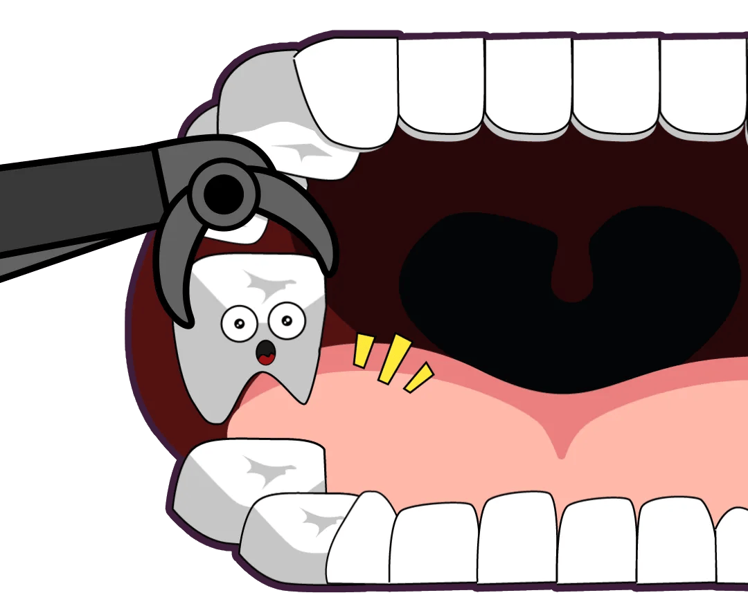 简单拔个牙,为什么医生要我拍片?