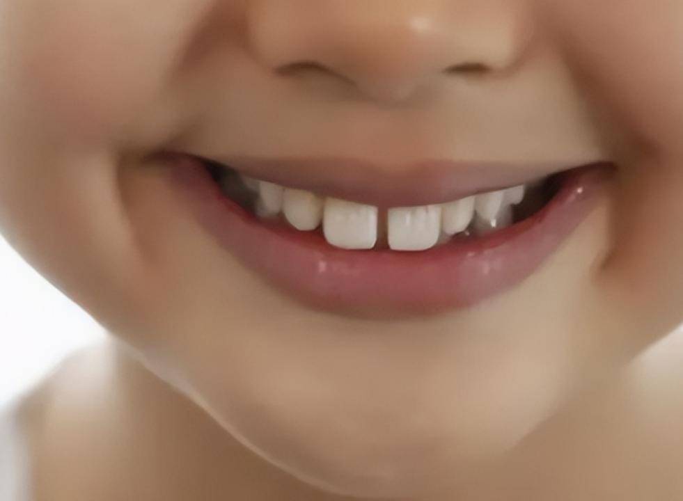 俗话说"上门牙有缝,处处硝烟盛"说的是啥意思?有没有道理?